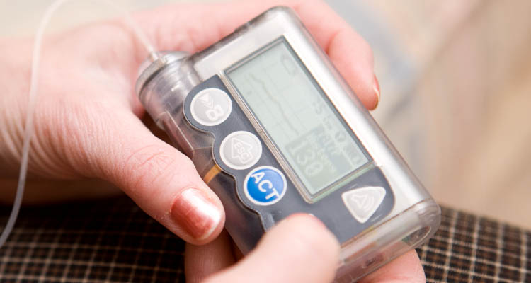 Hand hält ein digitales Insulinpumpengerät mit sichtbarem Display und mehreren Tasten.