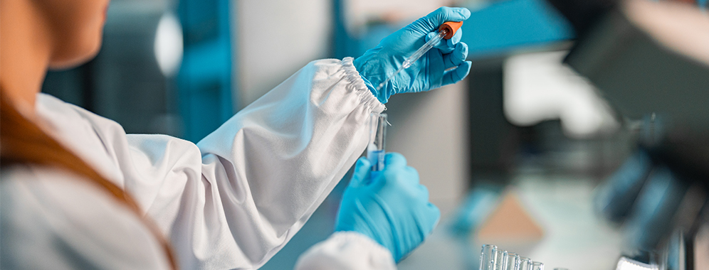 Man sieht eine Laborantin, die mit einer Pipette und einem Reagenzglas hantiert.