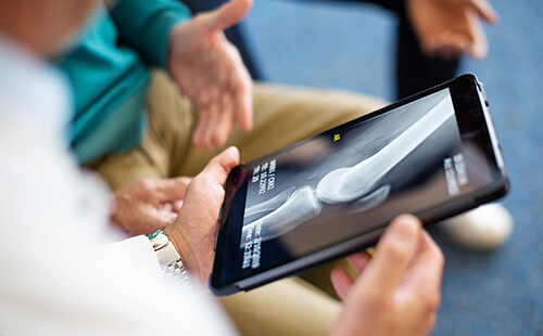 Personen schauen sich ein Röntgenbild von Knochen auf dem Tablet an. 