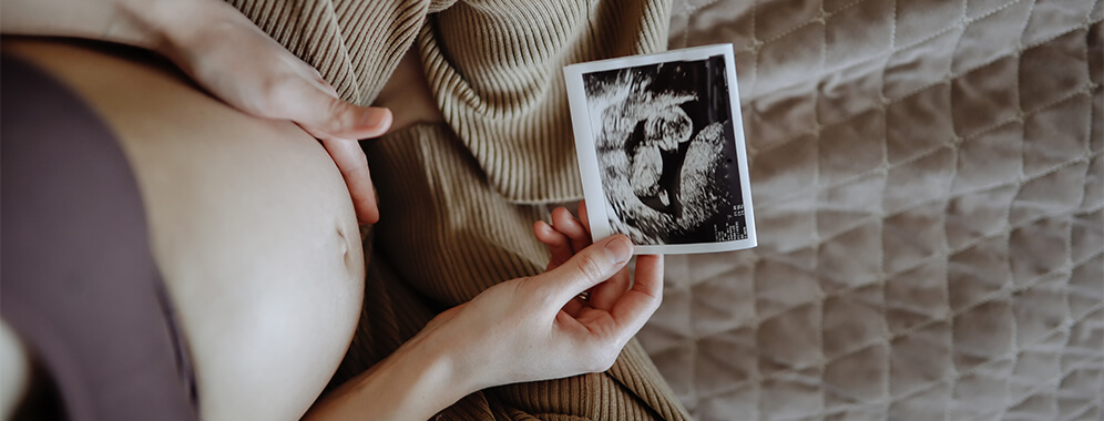 Eine Frau hält ihren Bauch und ein Ultraschallfoto in der Hand. 