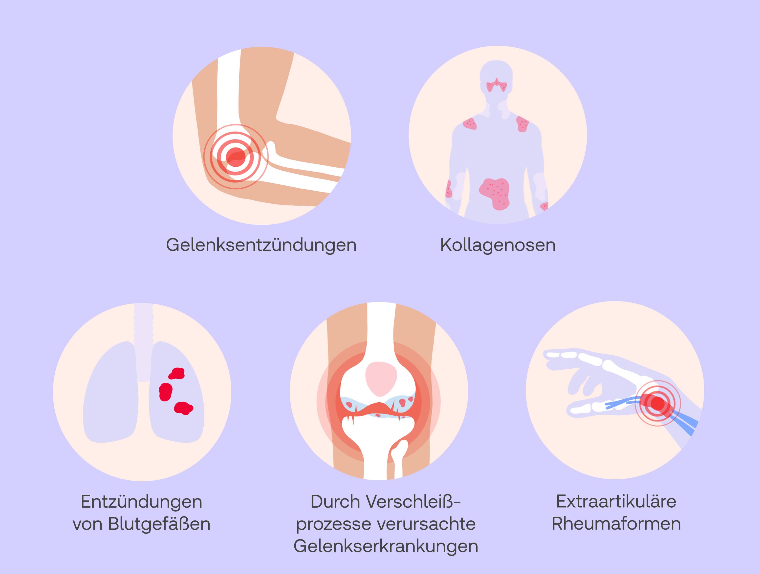 Antirheumatika Anwendungsbereiche