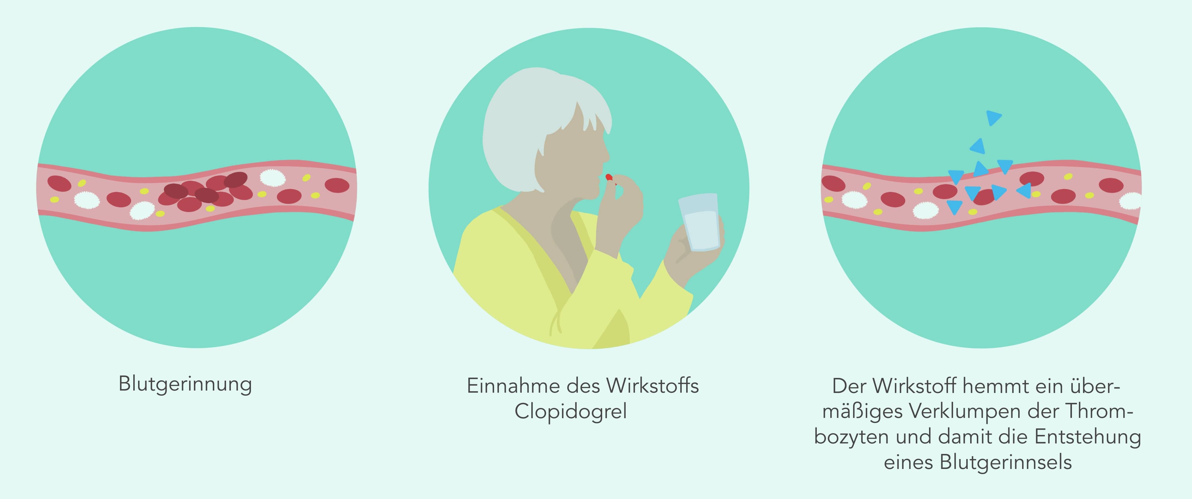 Wie Wirkt Clopidogrel Auf Den Blutdruck www.shop-apotheke.com