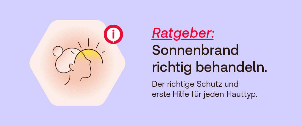 Was hilft gegen Sonnenbrand?