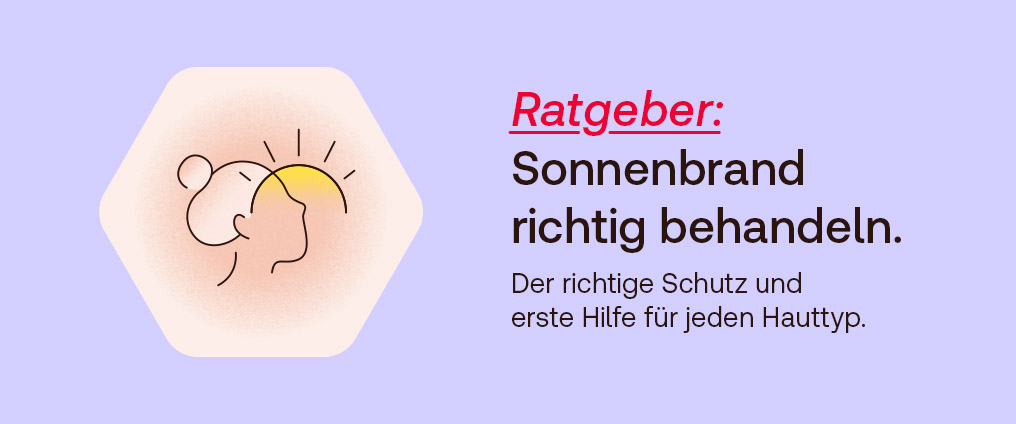 Was hilft gegen Sonnenbrand?