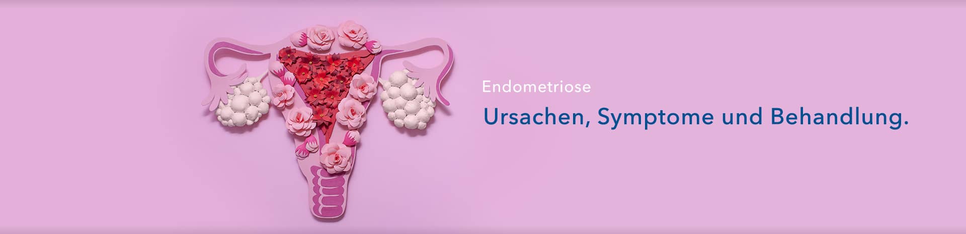 Ratgeber zu Endometriose
