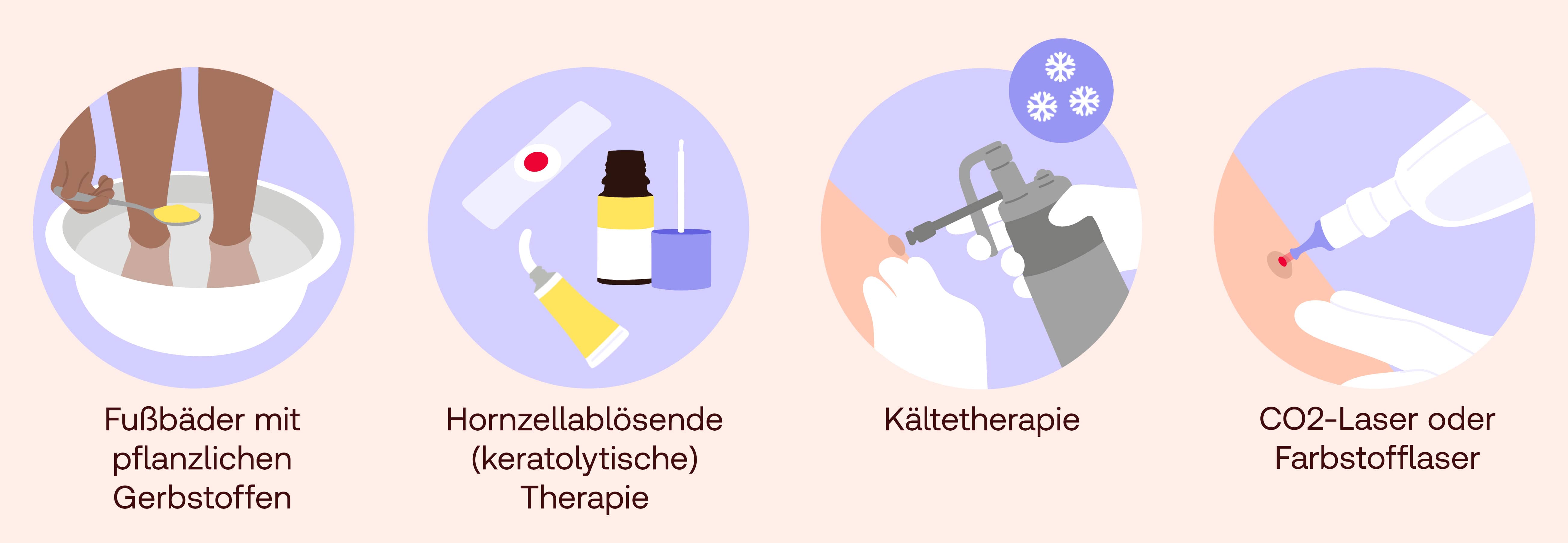 dornwarzen behandlung