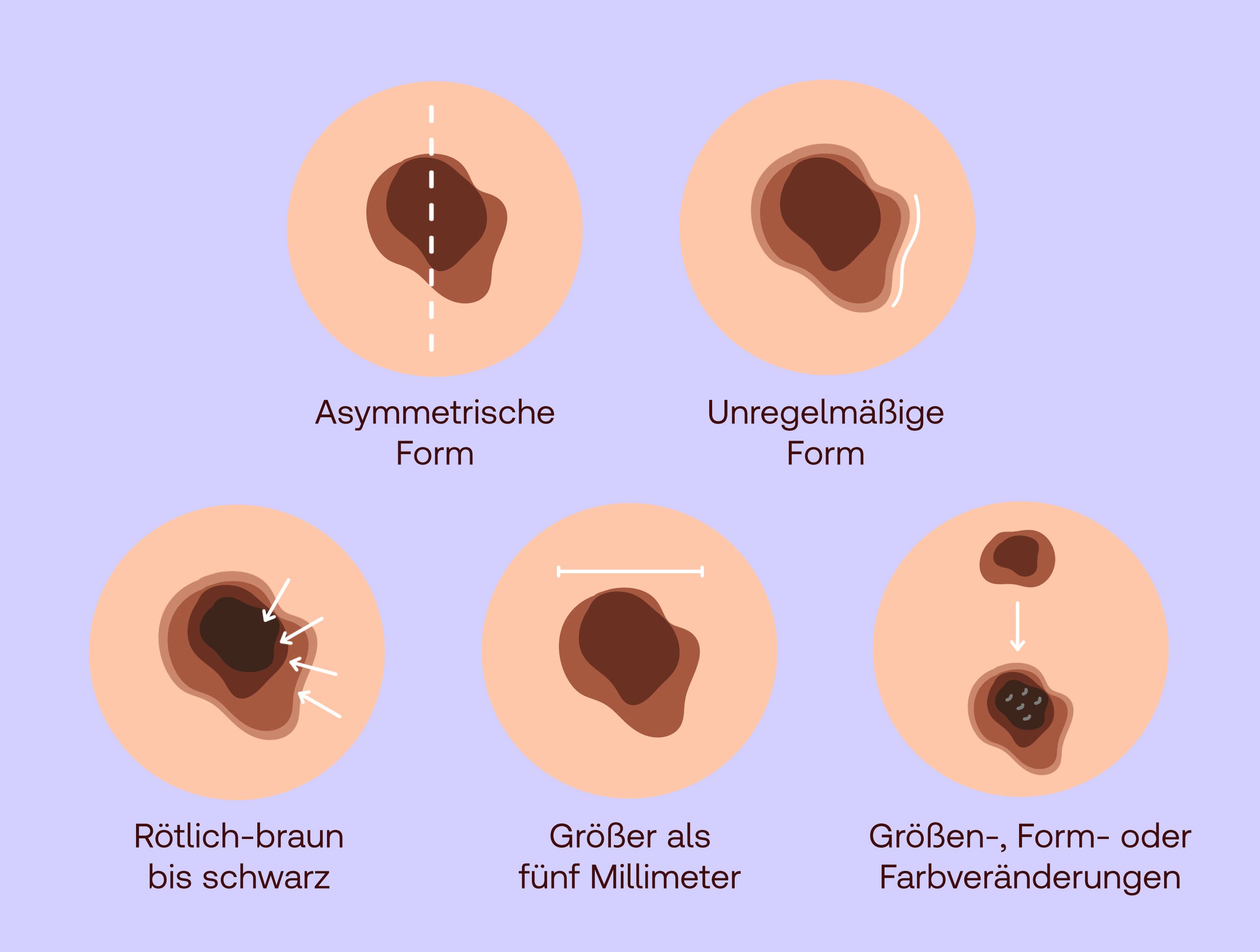 Hautkrebs Symptome