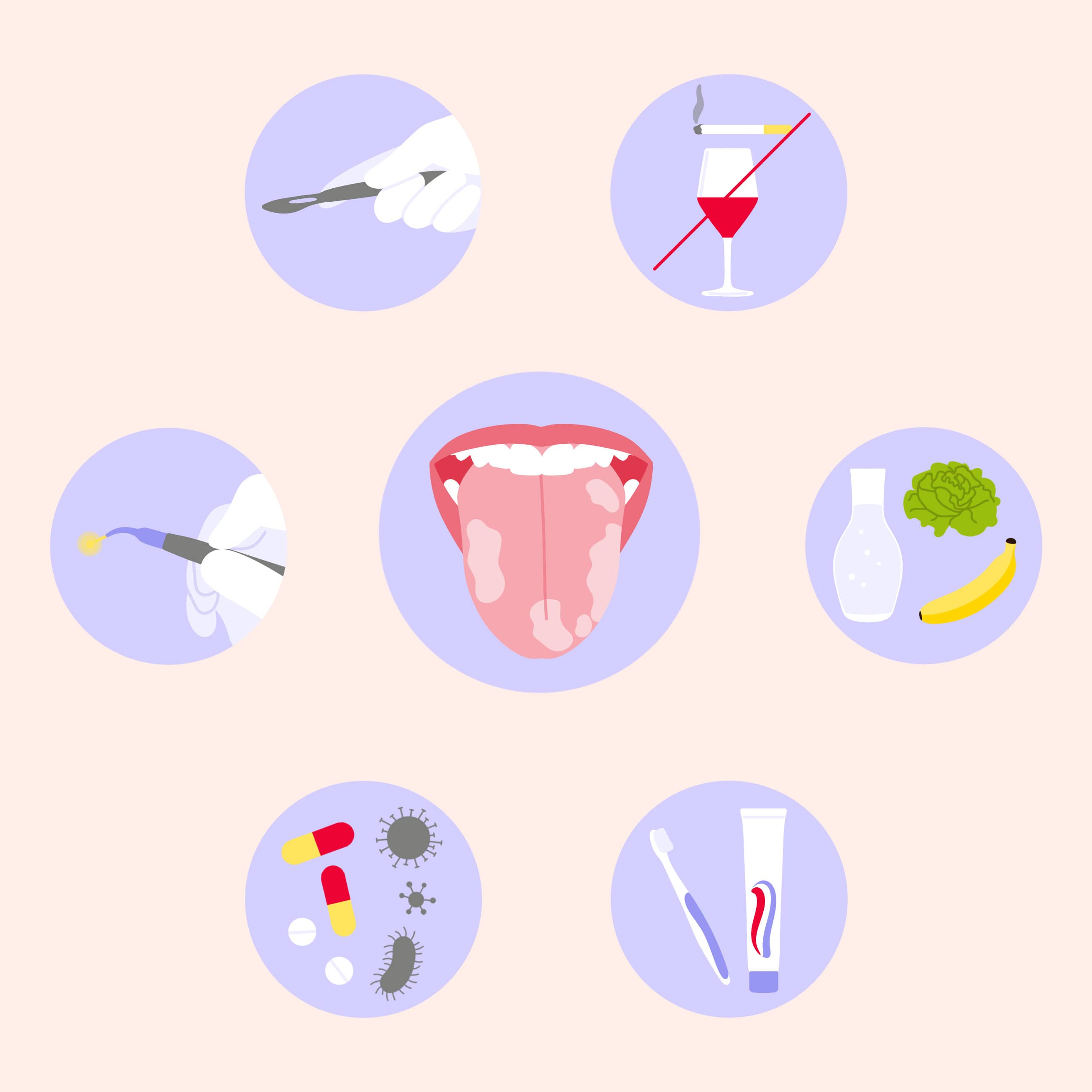 leukoplakie behandlung