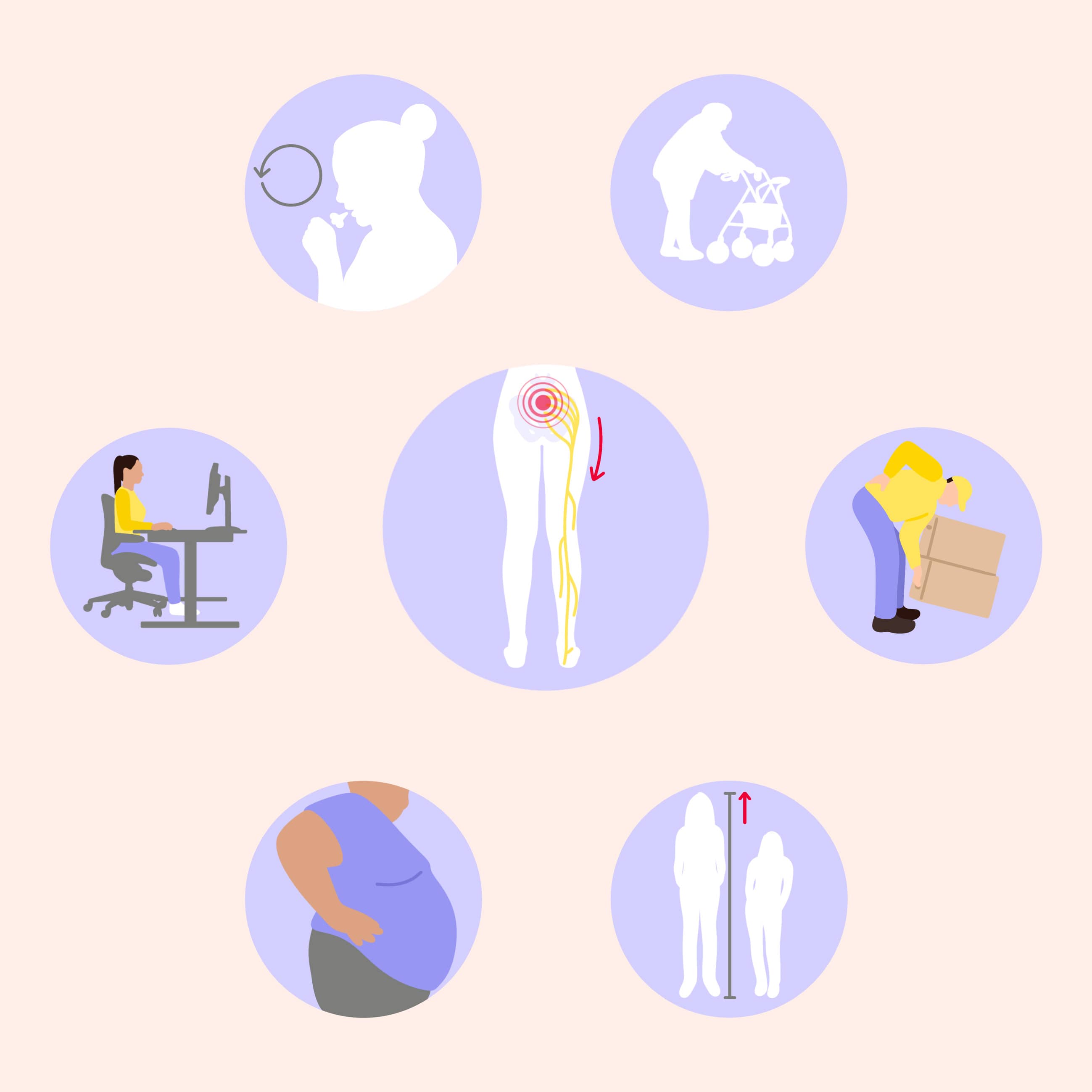 lumboischialgie risikofaktoren