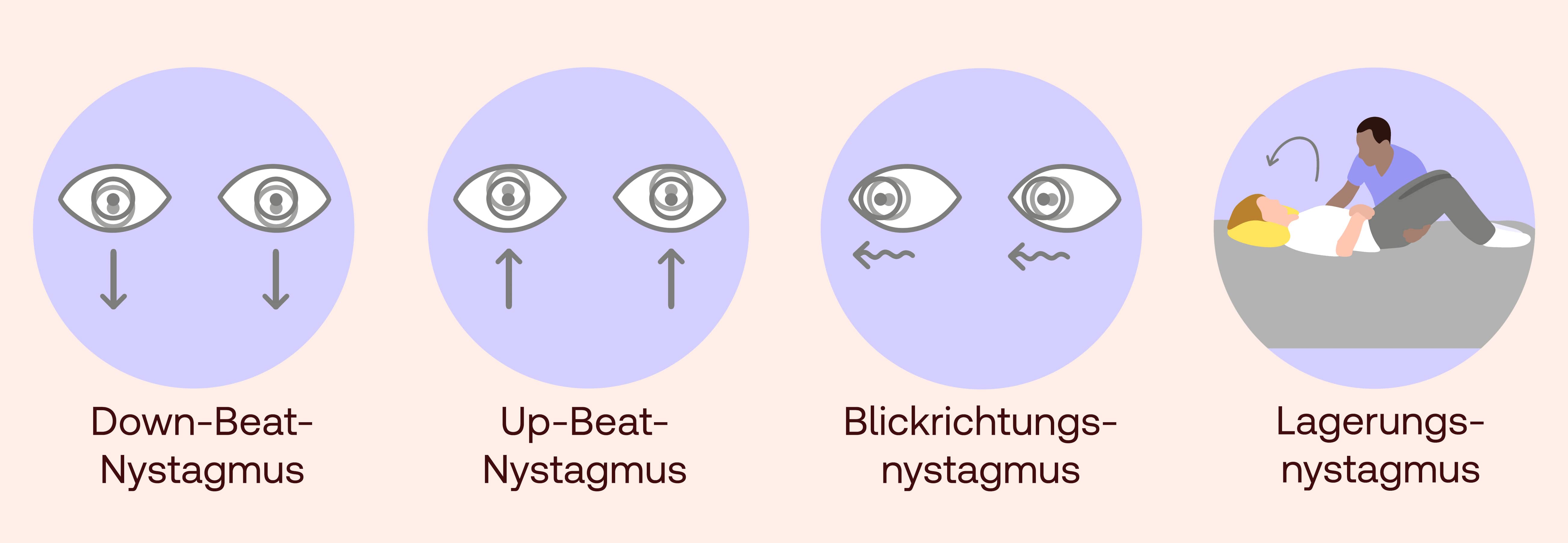 nystagmus symptome