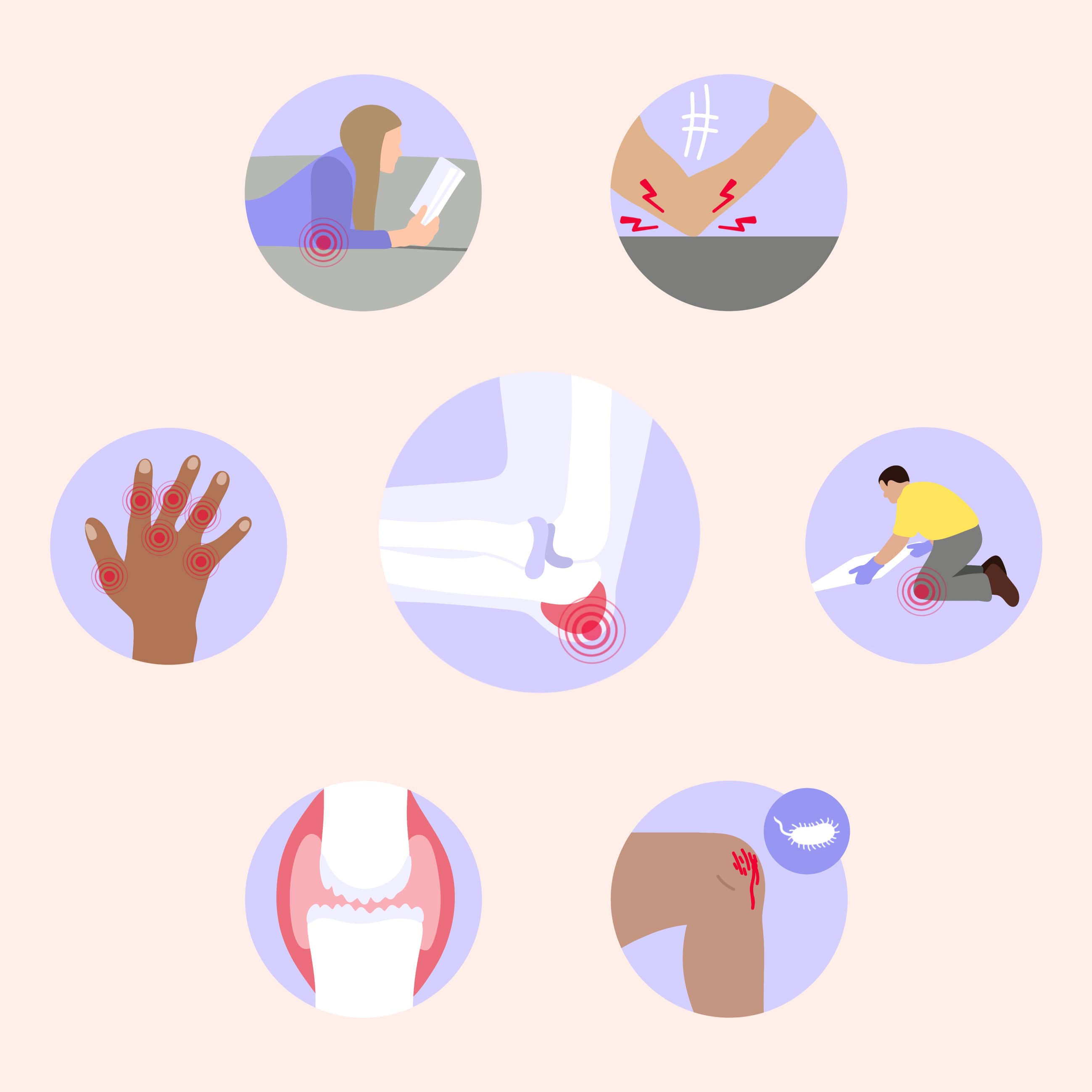 Schleimbeutelentzündung Ursachen