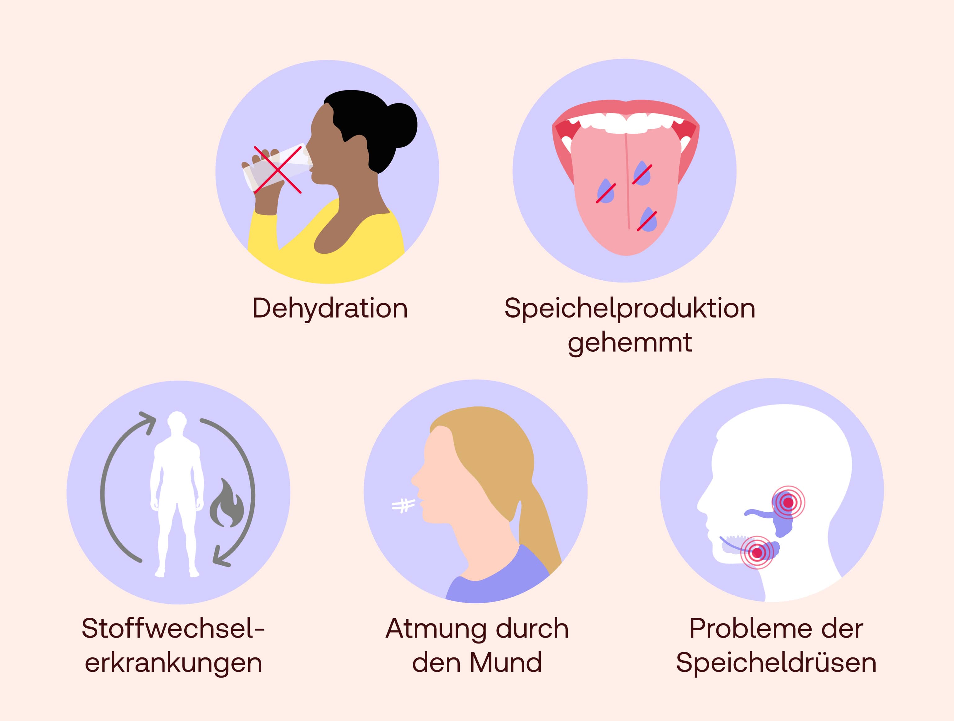 speichelsteine ursache