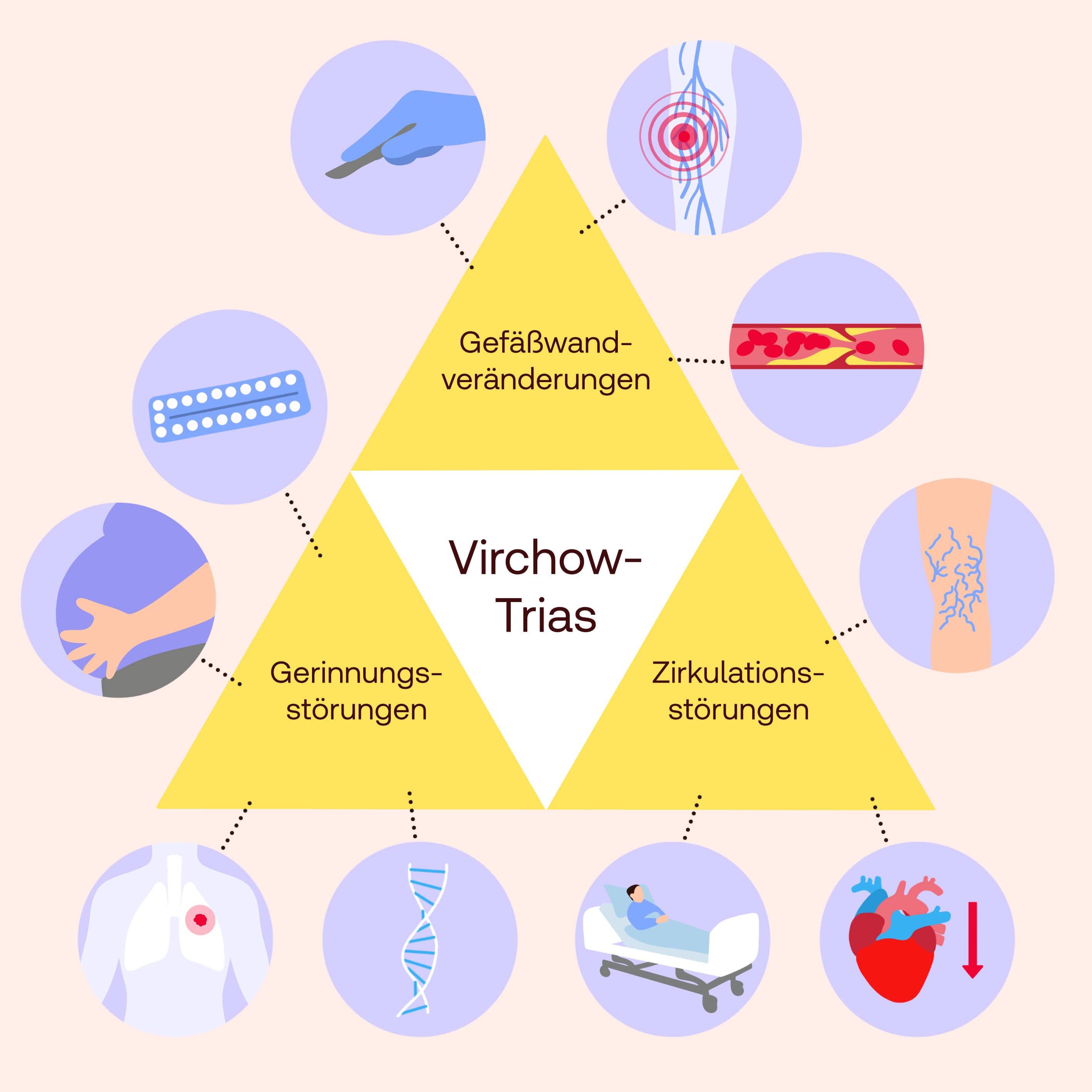 virchow trias