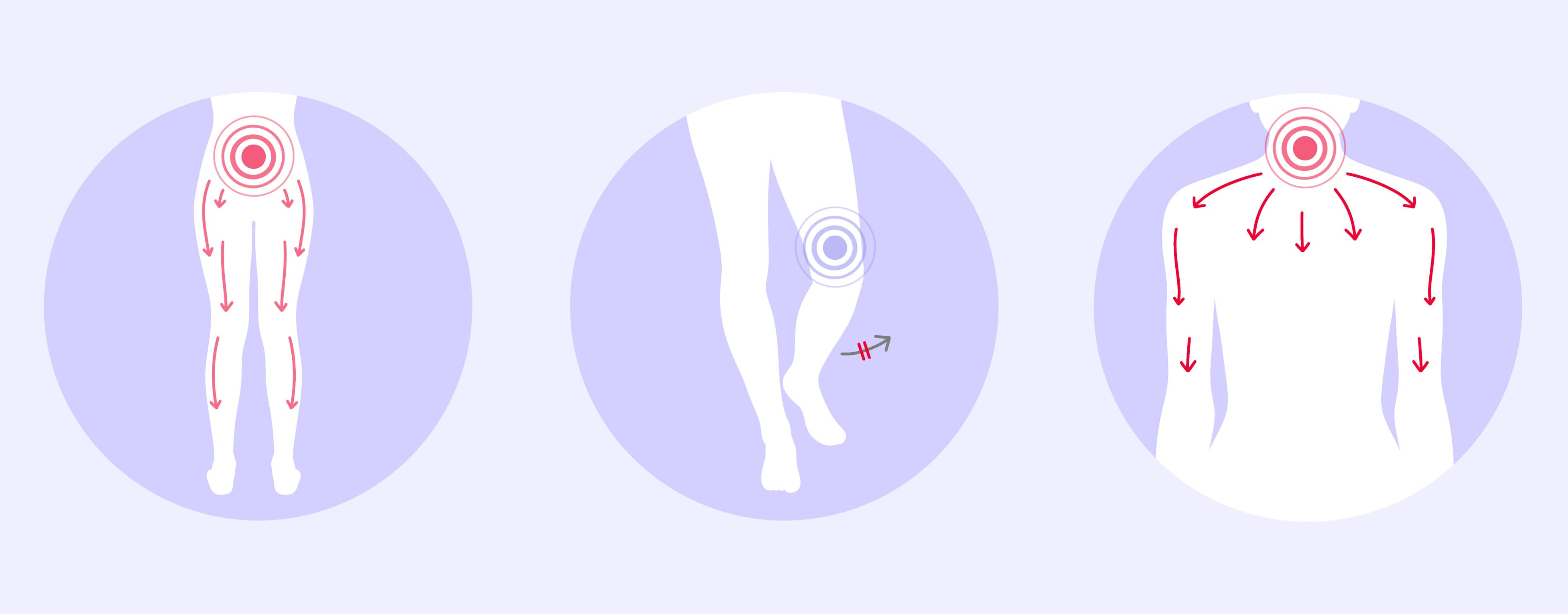 spinalkanalstenose symptome