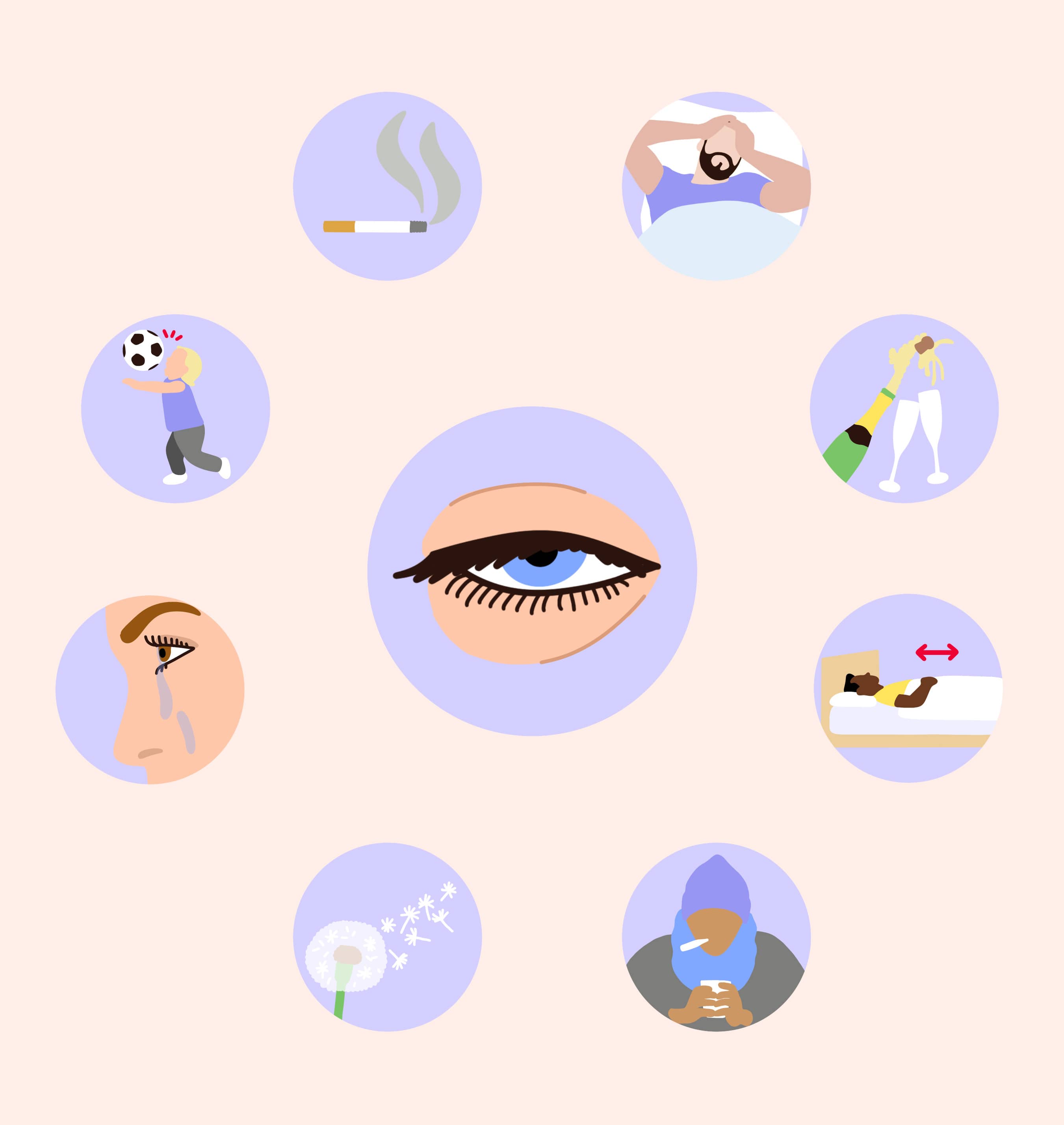 geschwollene Augen ursachen