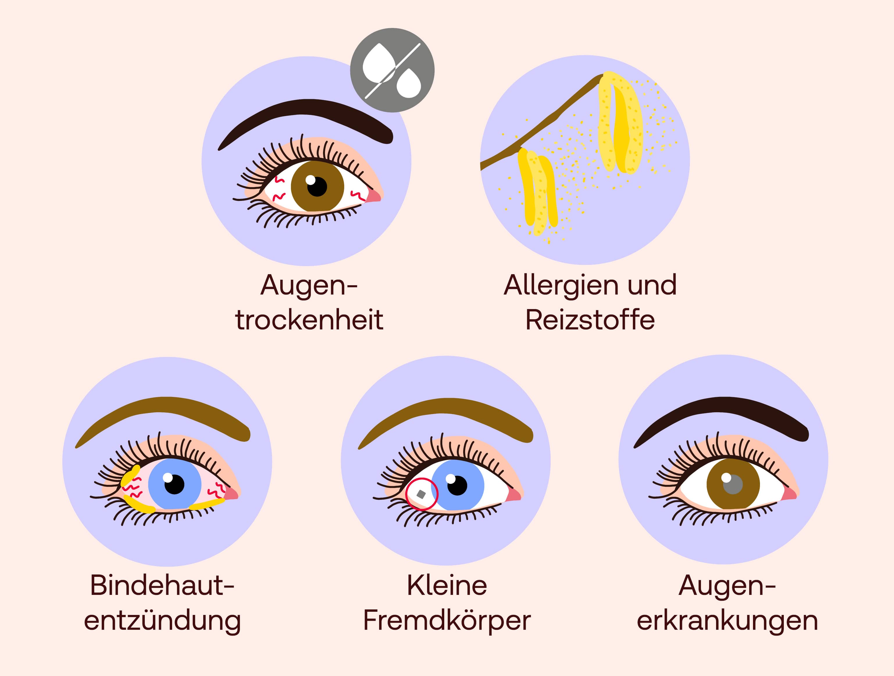 juckende augen ursachen