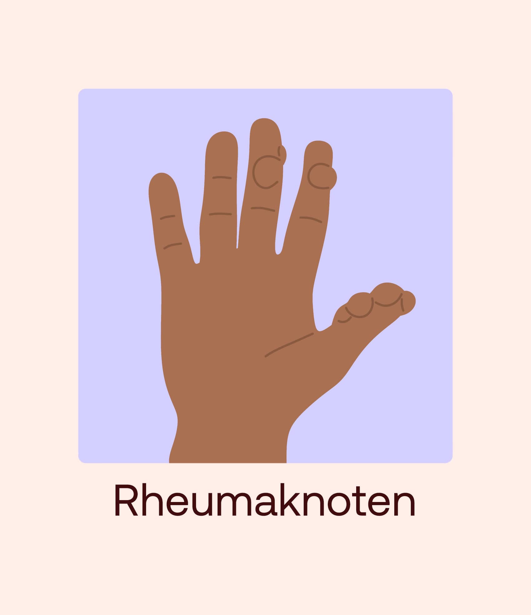 rheumaknoten