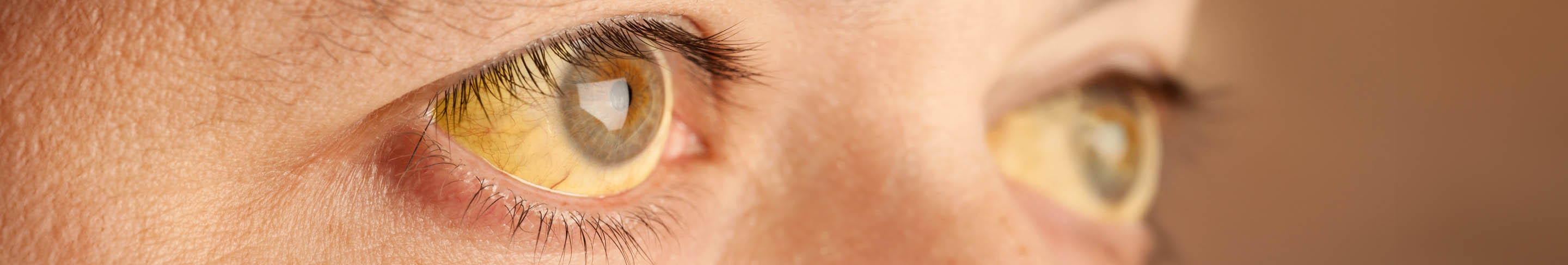 Gelbe Augen Banner