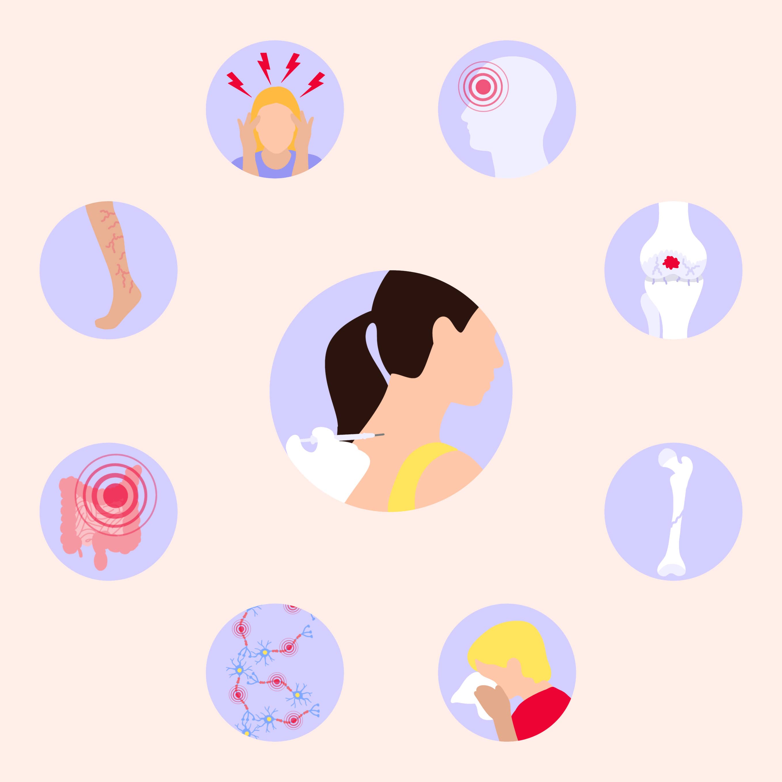 Neuraltherapie Anwendungsbereiche