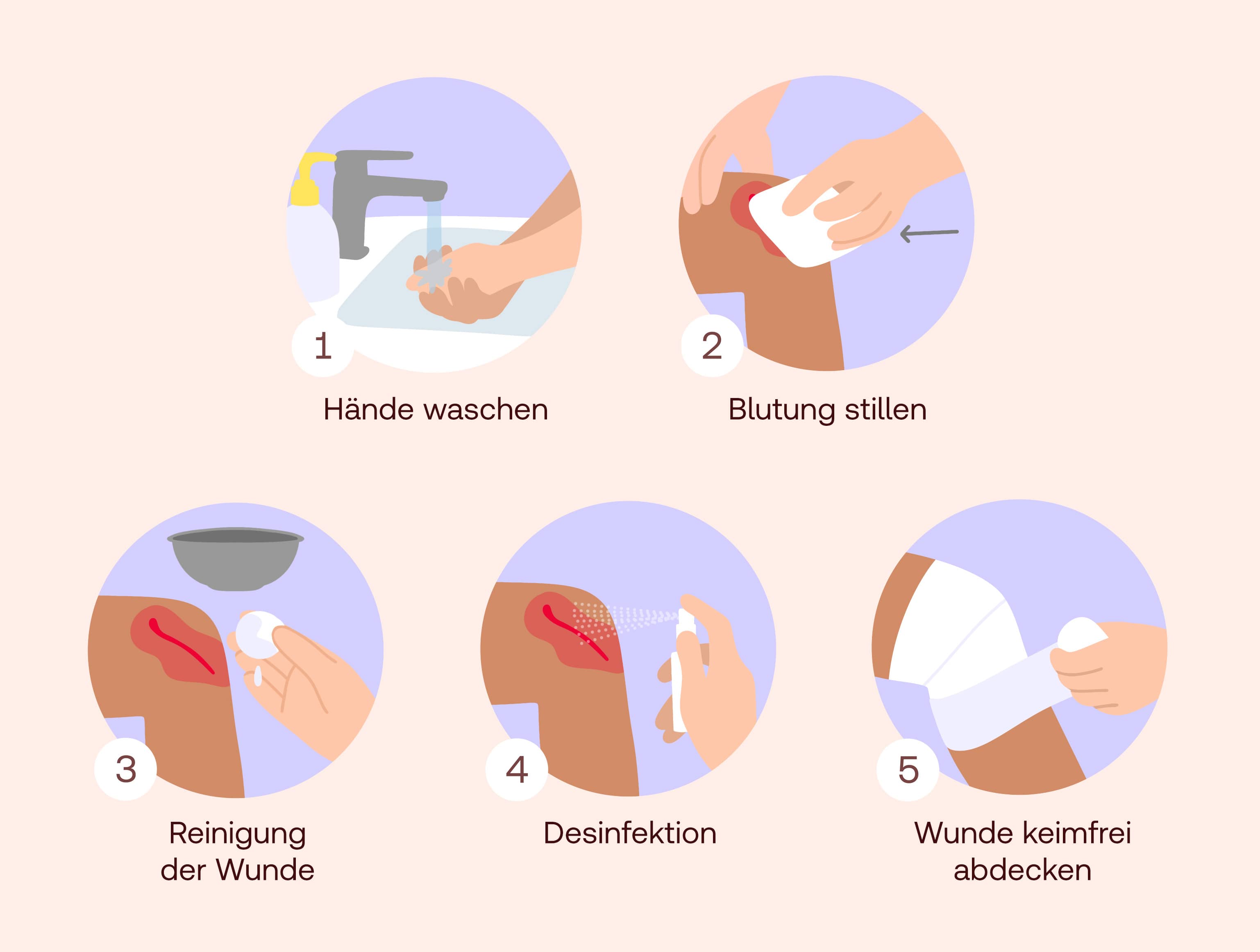 Wundversorgung Schritte