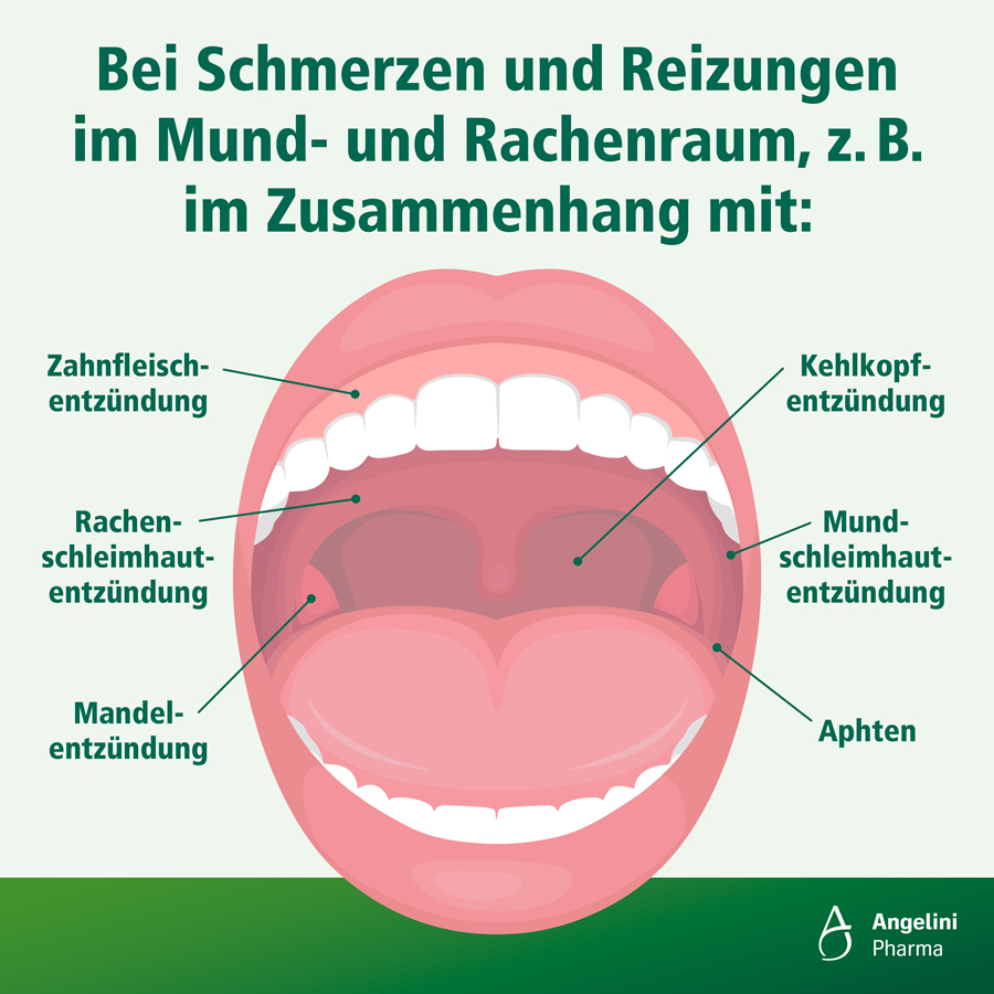 Tantum Verde Spray, 30 ml, in der Originalverpackung.