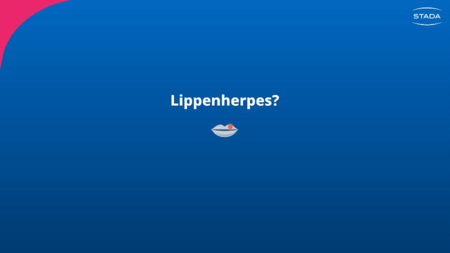 Aciclostad® Creme gegen Lippenherpes: Linderung von Schmerzen und Juckreiz.