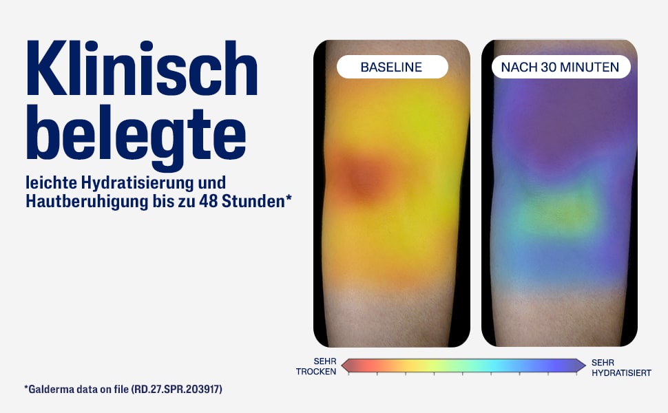 Arme mit Messwerten. Text: Klinisch belegte leichte Hydratisierung und Hautberuhigung bis zu 48 Stunden.