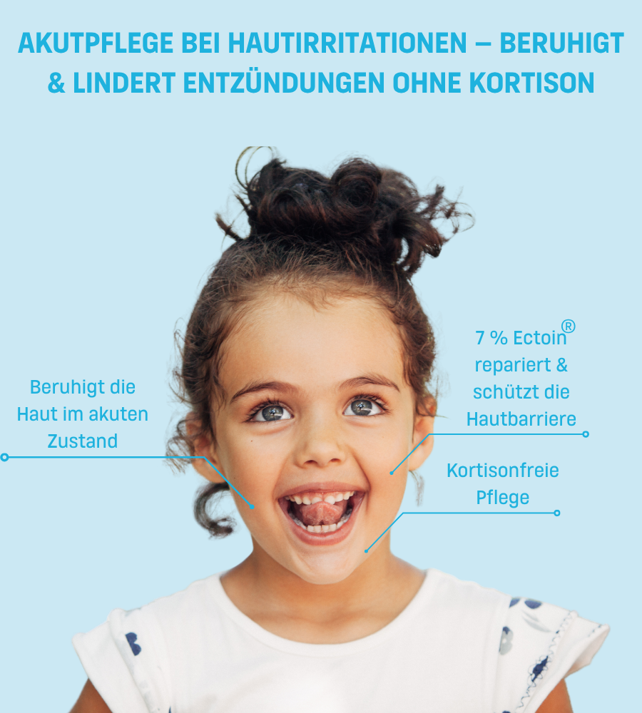 Kind mit Hautirritationen. Text: Akutpflege bei Hautirritationen. 7% Ectoin.