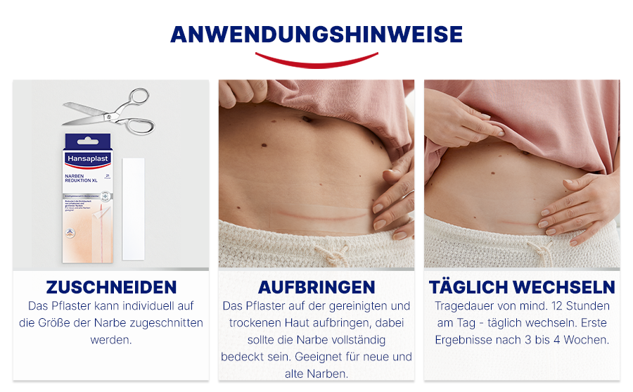 Anwendungshinweise. Zuschneiden, Aufbringen, Täglich wechseln. Illustrationen.