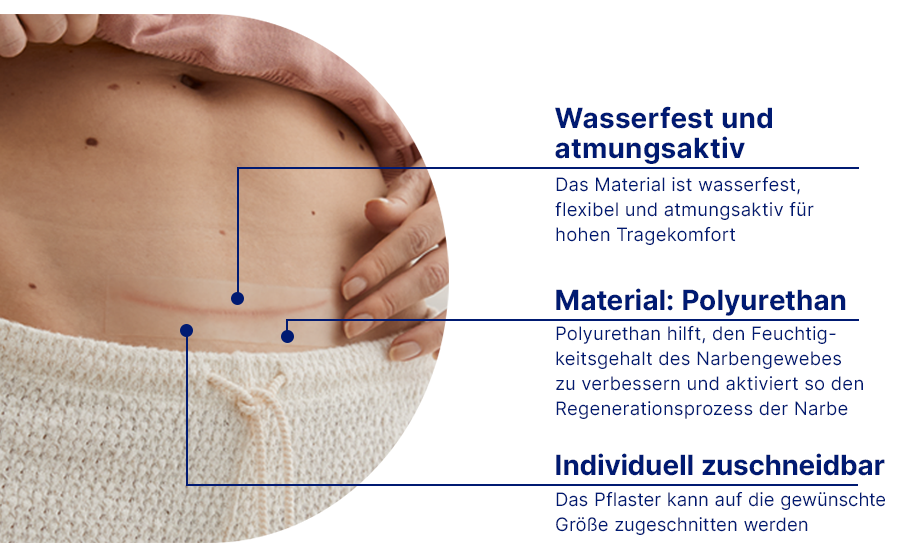 Wasserdicht und atmungsaktiv. Material: Polyurethan. Individuell zuschneidbar. Illustration.