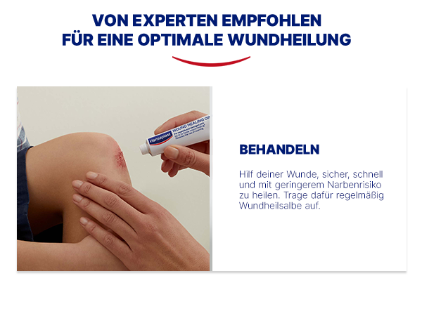 Person behandelt Knie mit Wundsalbe. Text: Von Experten empfohlen für eine optimale Wundheilung. Behandeln.