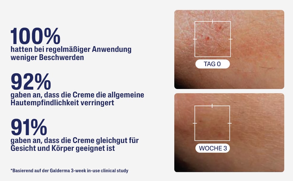 Text: 100% weniger Beschwerden, 92% weniger Hautempfindlichkeit, 91% geeignet für Gesicht/Körper.