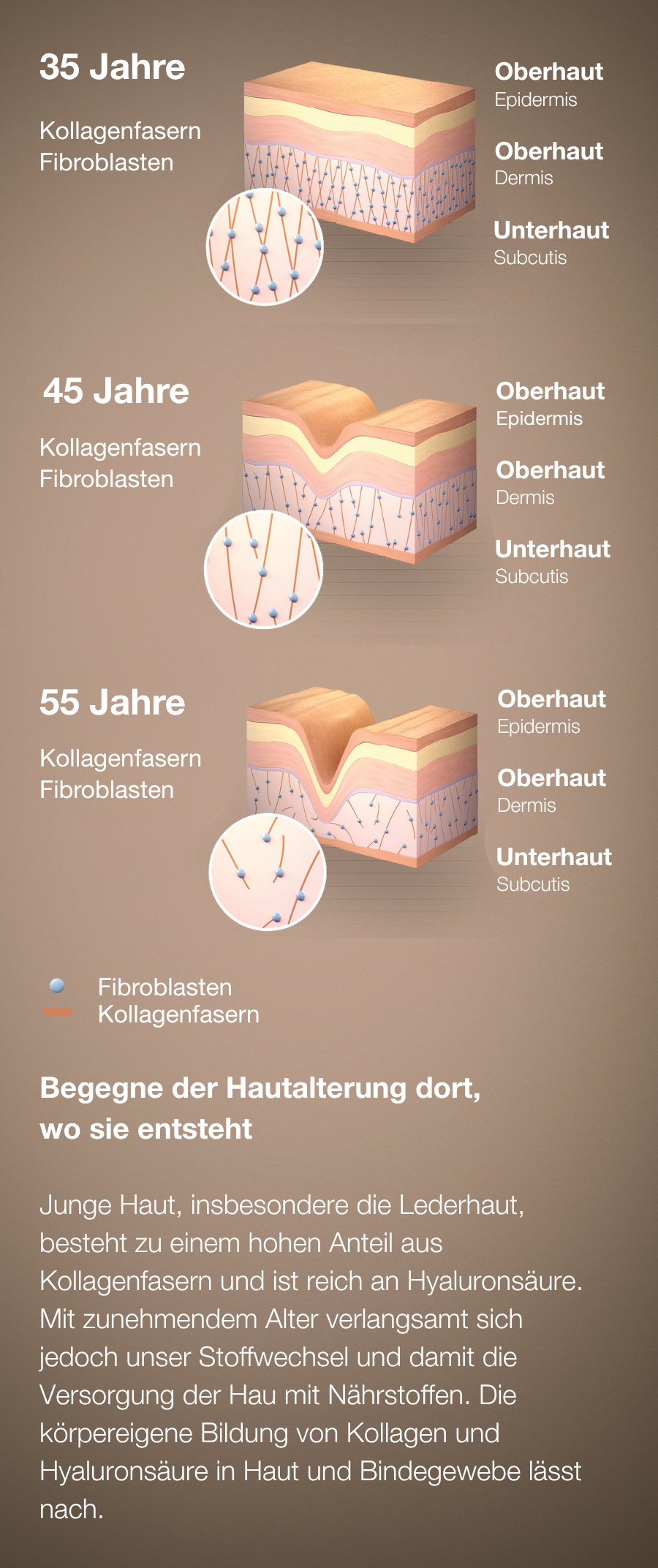 Hautalterung. Grafik, die die Hautalterung in verschiedenen Altersstufen zeigt.