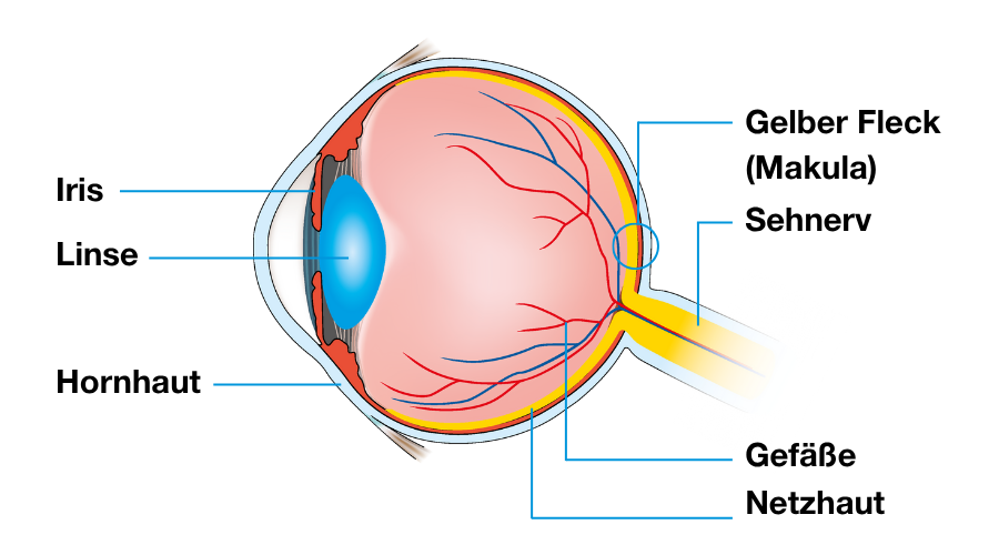 Augenmodell mit Beschriftungen: Iris, Linse, Hornhaut, Gelber Fleck, Sehnerv, Gefäße, Netzhaut.