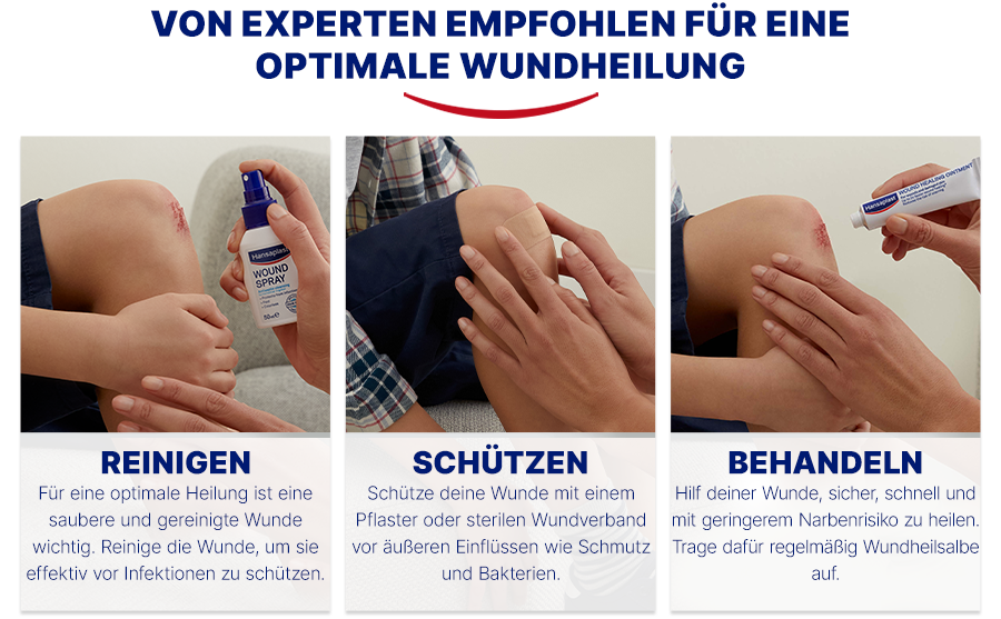 Drei Bilder zeigen Wundversorgung. Reinigung, Schutz, Behandlung. Produkte: Wundspray, Pflaster, Salbe.